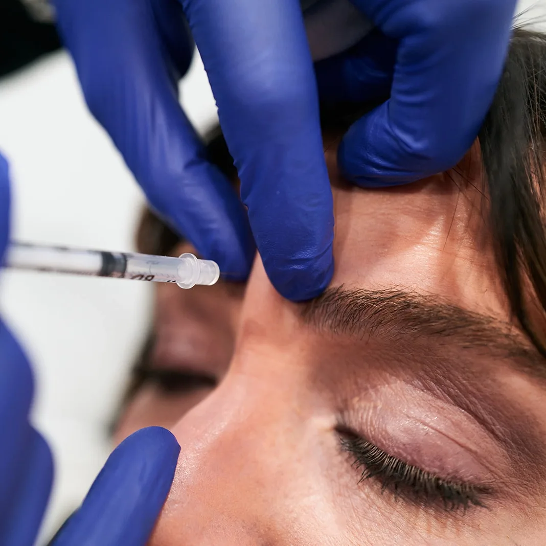 Patient getting injections in between her eyebrows