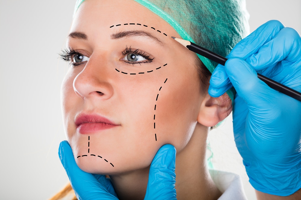 Understanding the Deep Plane Facelift