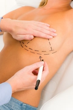 Questions to Ask Your Breast Augmentation Plastic Surgeon