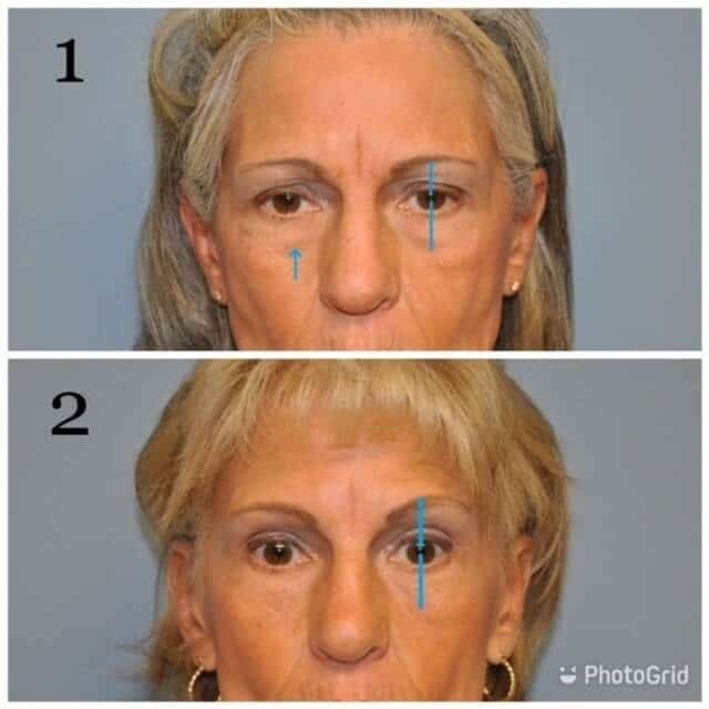 What are the characteristics of an attractive eyebrow – Part 2