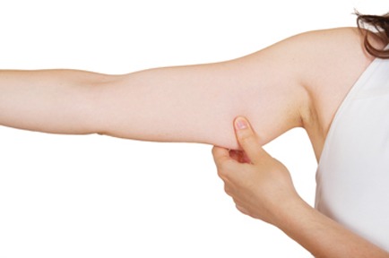 Liposuction Of The Arms